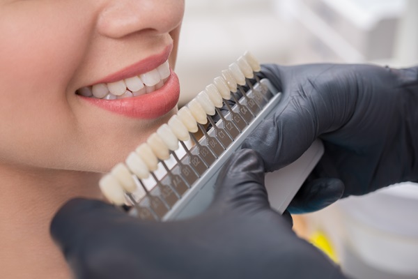 The Step By Step Process Of Getting Dental Veneers