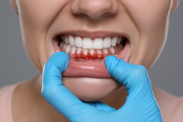 What Is Periodontics?